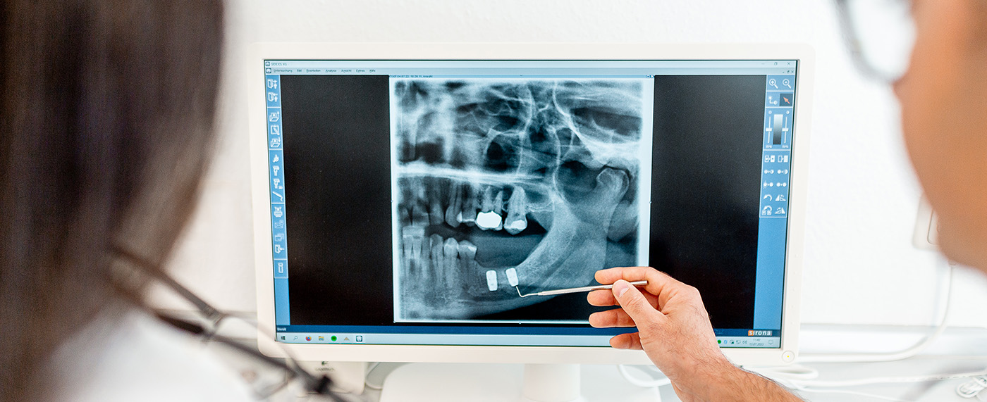 Vor der Implantatsetzung in Darmstadt röntgt Zahnarzt Daniel Krutsch die Kiefer der Patienten. Hier sieht er sich ein Röntgenbild an.